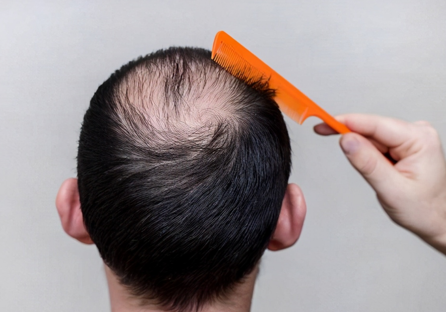 科学补硒的5大原则（如何理解科学补硒）-硒宝网