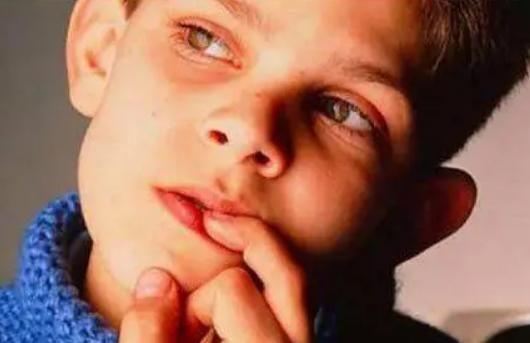 补锌的水果有哪些(补锌水果前十名)-硒宝网