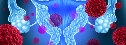 补硒抗宫颈癌有用吗(宫颈癌补硒有用吗)-硒宝网