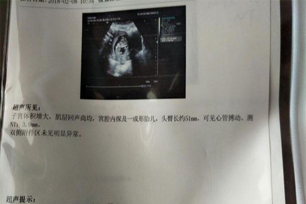 补钙胶囊(胶囊补钙怎么吃)-硒宝网