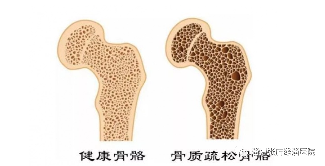 补钙是液体钙好还是钙片好(钙片液体钙哪个好)-硒宝网