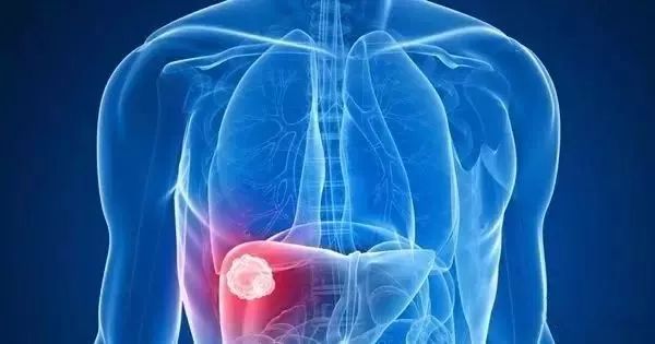 全民补硒日百度百科(517全民补硒)-硒宝网