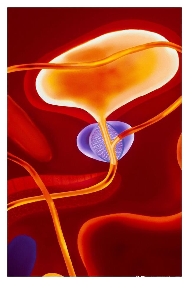 补硒能治前列腺炎吗(补硒前列腺)-硒宝网