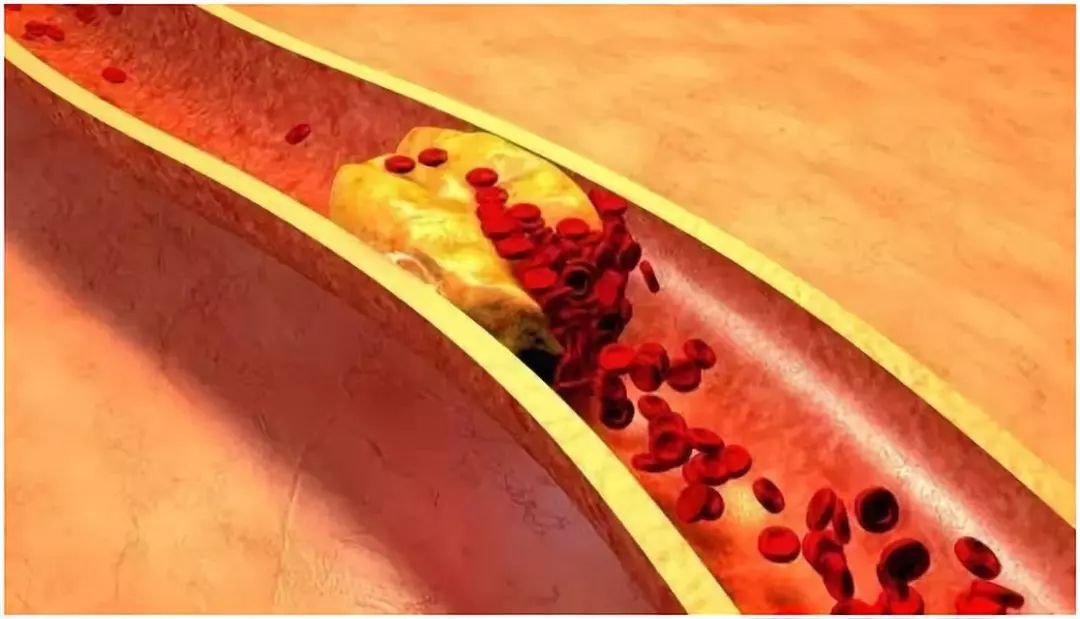 大动脉炎需要补硒吗（人需要终身补硒吗）-硒宝网