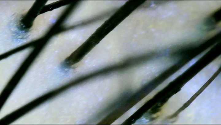 掉发是缺什么微量元素(缺微量元素头发会变白吗)-硒宝网