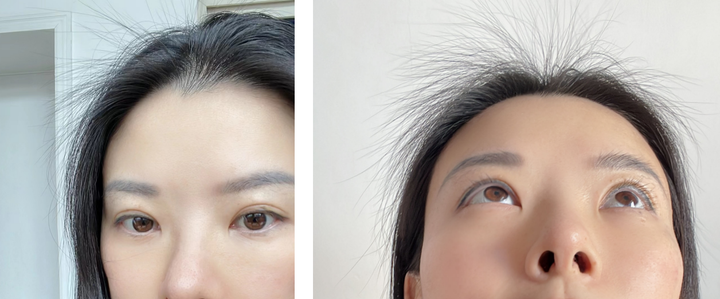 掉发是缺什么微量元素(缺微量元素头发会变白吗)-硒宝网