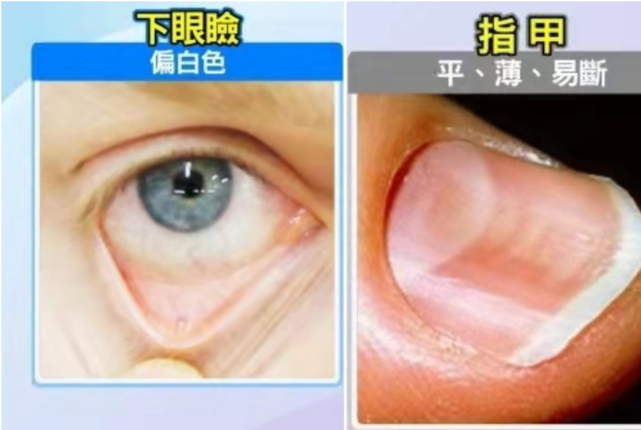 掉发是缺什么微量元素(缺微量元素头发会变白吗)-硒宝网