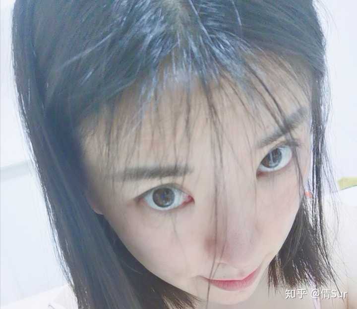 掉发是缺什么微量元素(缺微量元素头发会变白吗)-硒宝网