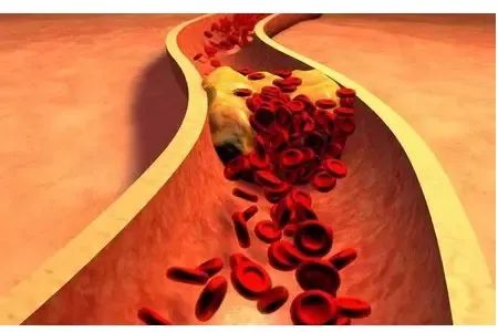 心脑血管病要补硒吗（血管脑病补心硒要多长时间）-硒宝网