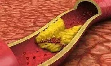 心脑血管病要补硒吗(硒心脑血管)-硒宝网