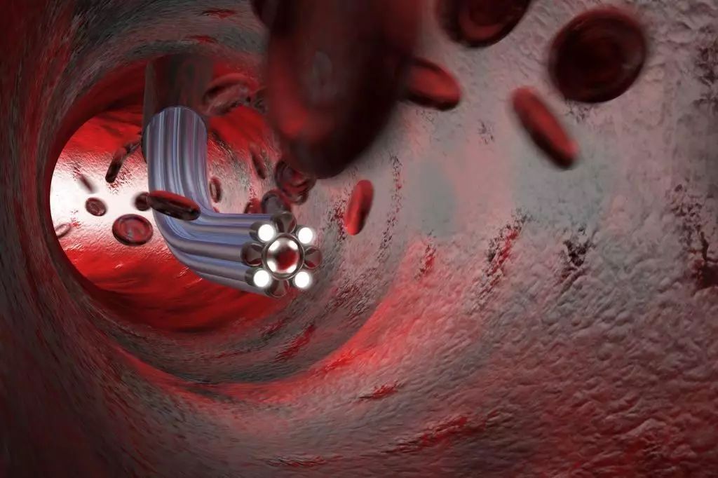 什么粥补硒好一点儿(富硒粥米煮稀饭还是干饭好)-硒宝网