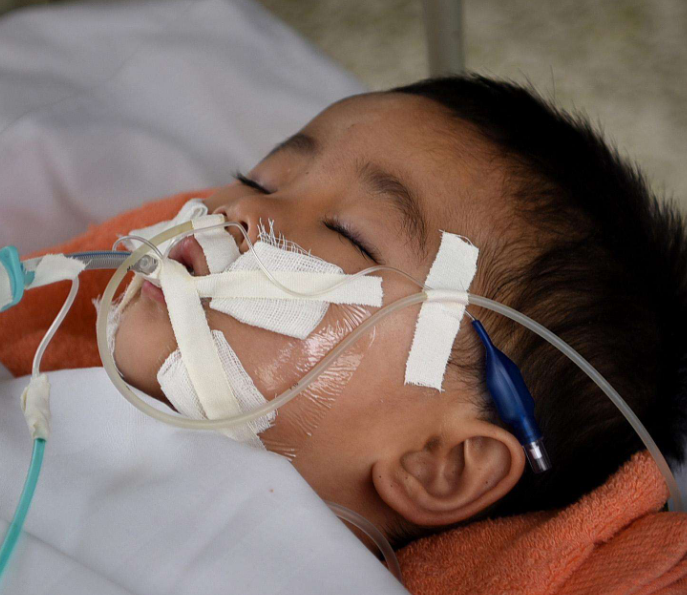 孩子不缺锌可以补锌吗(孩子缺锌能补回来吗)-硒宝网