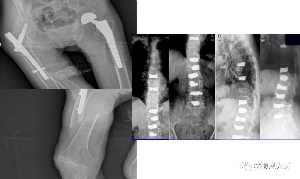 吃了d3还要补钙吗(补钙还要吃ad吗)-硒宝网