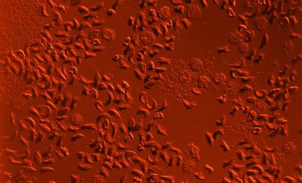 补铁的钙片(什么钙片补铁)-硒宝网