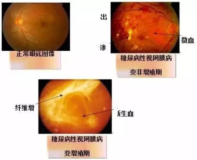 补微量元素吃什么药好(补充微量元素的药都有哪些)-硒宝网