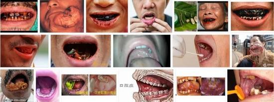 富硒是谁发明的产品(发明富硒产品是谁提出的)-硒宝网