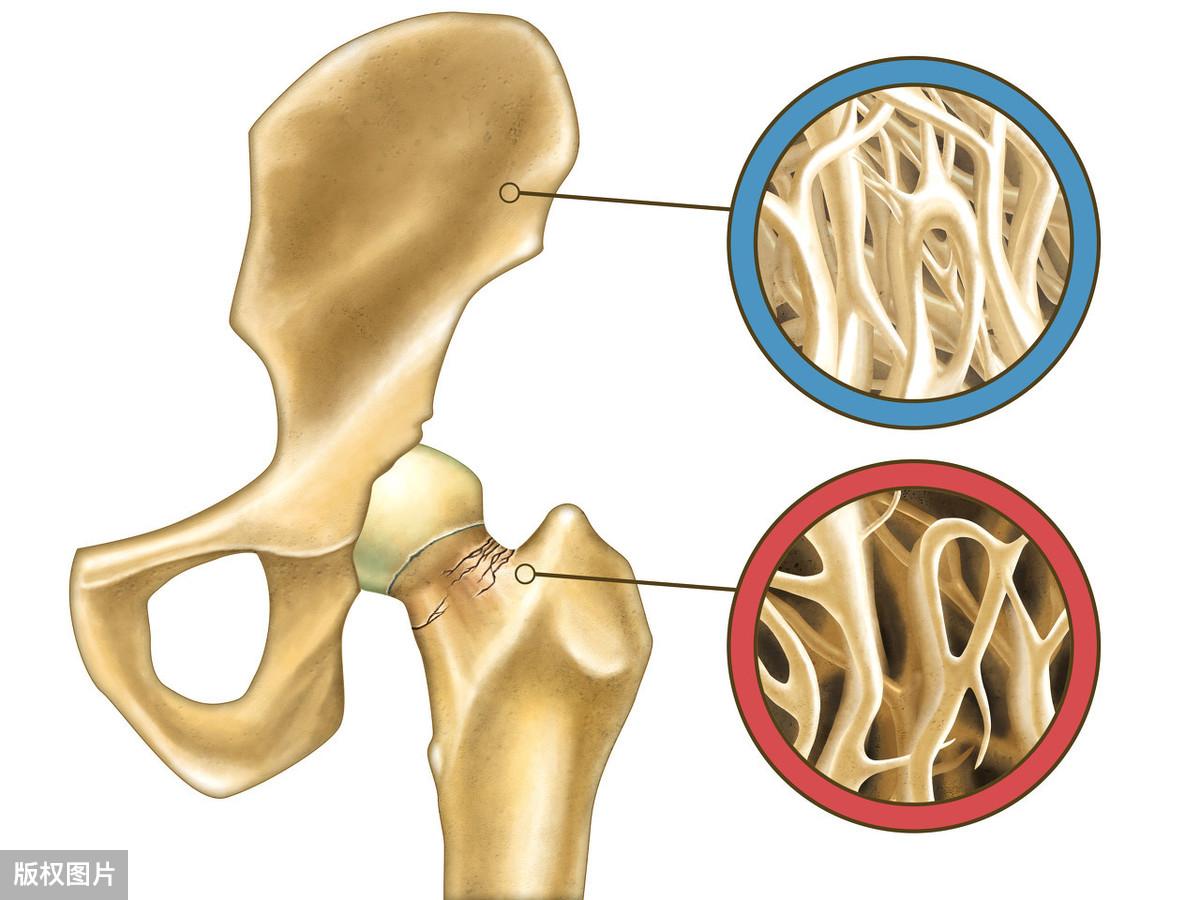 更年期补钙吃什么好(更年期期补钙)-硒宝网