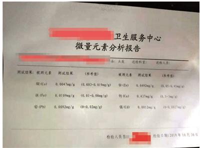 微量元素检查报告单（微量元素报告检查单子图片）-硒宝网