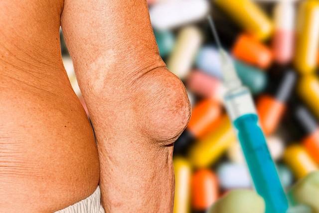 补钙不吸收怎么办(补钙吸收好的食物)-硒宝网