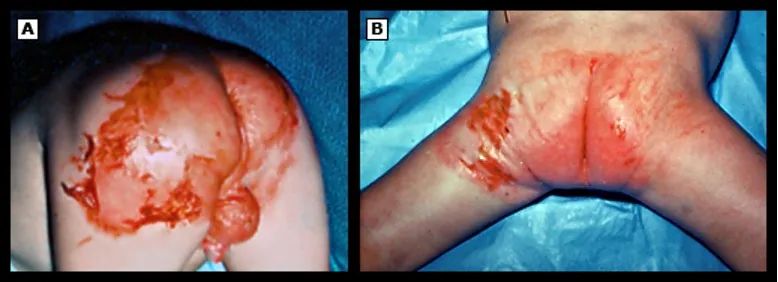 补充微量元素（微量补充元素有哪些）-硒宝网