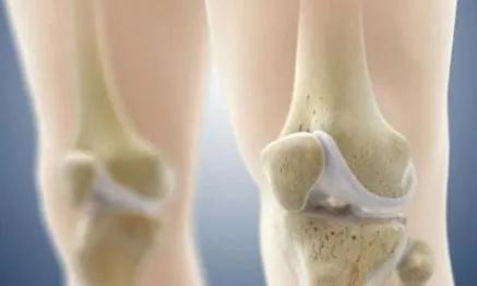 中老年人怎样补钙（补钙老年人中药方剂）-硒宝网