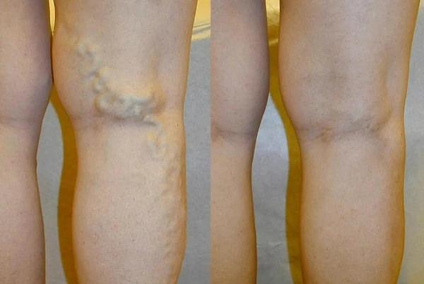 中老年人怎样补钙（补钙老年人中药方剂）-硒宝网