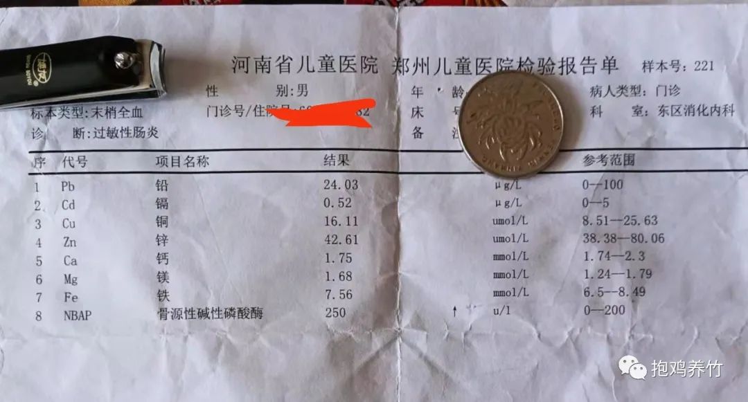 儿童测微量元素挂哪科(微量元素挂什么科儿童医院)-硒宝网