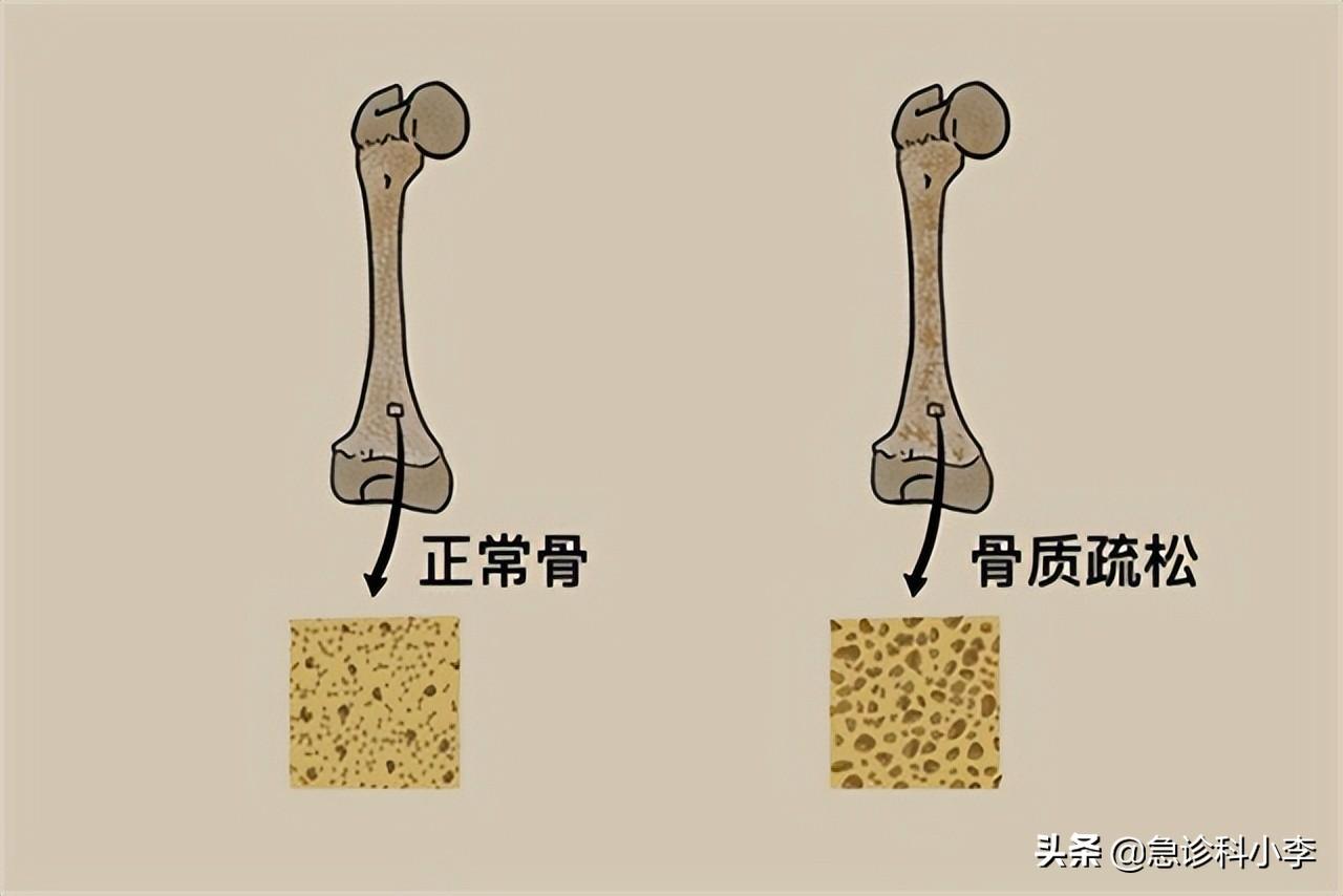 成年女性补钙吃什么钙片好(成年女性补钙有什么好处)-硒宝网