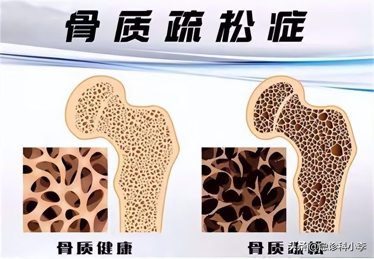 成年女性补钙吃什么钙片好(成年女性补钙有什么好处)-硒宝网