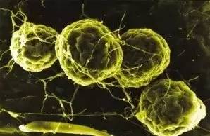 富硒黑茶什么时候喝(黑茶含硒)-硒宝网