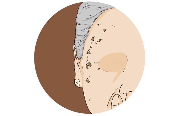 什么情况下需要补钙（补钙情况下需要补钙吗）-硒宝网