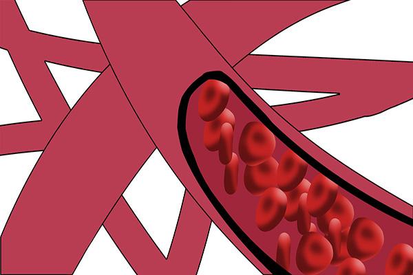 什么情况下需要补钙（补钙情况下需要补钙吗）-硒宝网