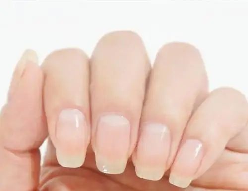 缺微量元素指甲图片（指甲缺微量元素带图文）-硒宝网
