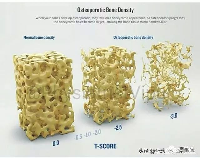 50岁补钙吃啥钙片好(补钙吃钙片好还是氨糖软骨素好)-硒宝网