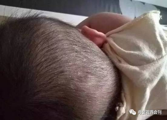 婴儿有必要补钙吗(必要婴儿补钙有哪些药)-硒宝网