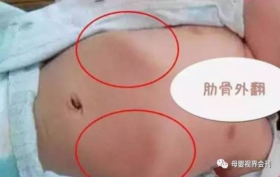 婴儿有必要补钙吗(必要婴儿补钙有哪些药)-硒宝网