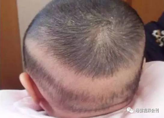 婴儿有必要补钙吗(必要婴儿补钙有哪些药)-硒宝网