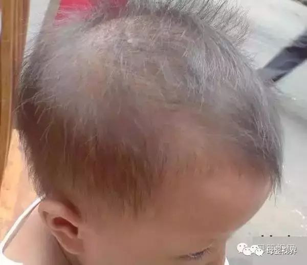 儿童补锌的10大品牌（儿童品牌补锌大剂有哪些）-硒宝网