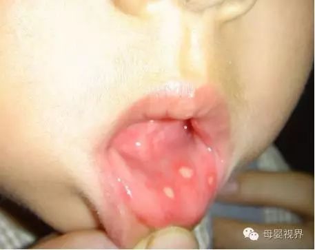 儿童补锌的10大品牌（儿童品牌补锌大剂有哪些）-硒宝网