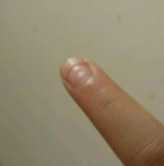 微量元素五项（微量元素缺乏会出现什么症状）-硒宝网