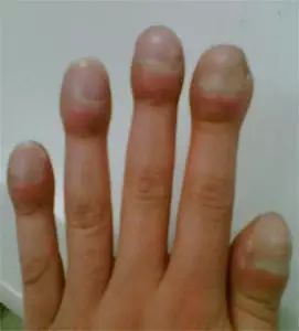 微量元素五项（微量元素缺乏会出现什么症状）-硒宝网