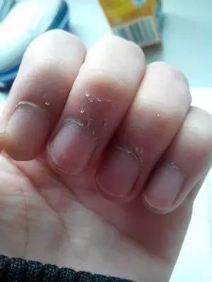 微量元素五项（微量元素缺乏会出现什么症状）-硒宝网