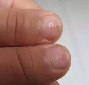 微量元素五项（微量元素缺乏会出现什么症状）-硒宝网