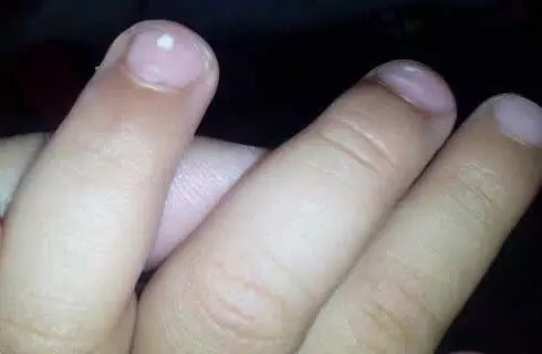 微量元素五项（微量元素缺乏会出现什么症状）-硒宝网