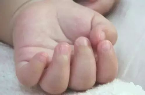 微量元素五项（微量元素缺乏会出现什么症状）-硒宝网