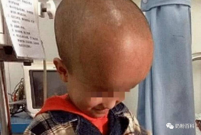 3岁宝宝补钙哪个牌子好（补钙吃什么牌子钙片好宝宝）-硒宝网