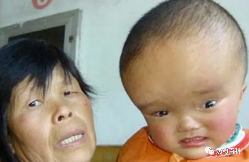 3岁宝宝补钙哪个牌子好（补钙吃什么牌子钙片好宝宝）-硒宝网