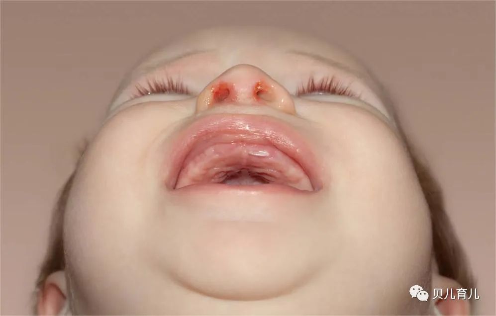 三个月宝宝要补钙吗(补钙宝宝要月经正常吗)-硒宝网