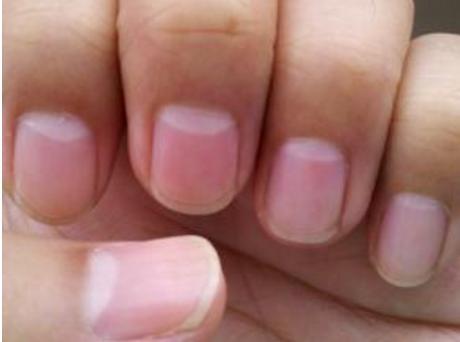 补铁是不是就是补血（补血补铁口服液十大排名）-硒宝网