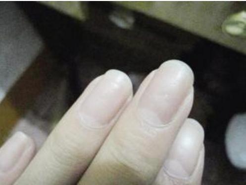 补铁是不是就是补血（补血补铁口服液十大排名）-硒宝网